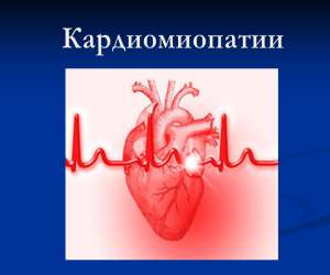 Презентация по медицине на тему: кардиомиопатии, для студентов.